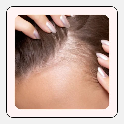 Thin Hair & Itchy Scalp